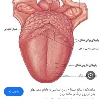 درمان کبد چرب با سونو رایگان گیاهان خوراکی|آرایشی، بهداشتی، درمانی|سمنان, |دیوار