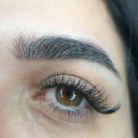 کاشت مژه هیدن رایگان