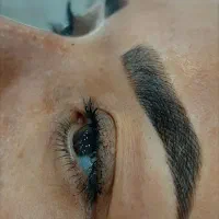 اصلاح کامل صورت ۱۵۰