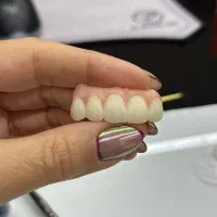 آموزش حرفه ای دندانسازی دیجیتال اگزوکد Exocad
