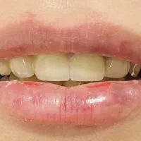 خدمات دندانپزشکی|خدمات آرایشگری و زیبایی|یاسوج, |دیوار