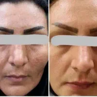 اصلاح مزاج|آرایشی، بهداشتی، درمانی|اردبیل, |دیوار