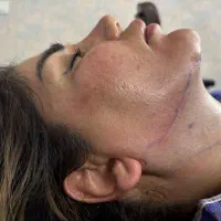 جشنواره تابستانه ،با زیر ده تومن بلفارو کن|خدمات آرایشگری و زیبایی|ری, اقدسیه|دیوار