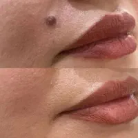 خالبرداری بانوان