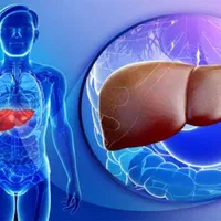 بهبود کبد چرب حتی گرید ۳