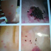 سم پاشی منازل و کارگاه های صنعتی و دام و طیور|خدمات نظافت|محمدیه-قزوین, |دیوار