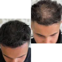 رویش و پرپشتی رو خیلی آسون تجربه کن