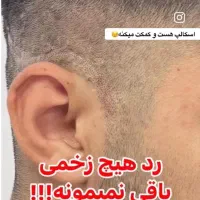 میکرو اسکالپ سر|خدمات آرایشگری و زیبایی|شهریار, شهرک وائین|دیوار