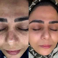 درمان هر مشکل پوستی