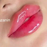 مطب گرگان عدالت ۱۳ بوتاکس ۸۰۰ ژل۱ تومان توسط پزشک|خدمات آرایشگری و زیبایی|گرگان, |دیوار