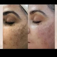 آموزش اسکالپ کف سر و فشیال پوست و کراتین ابریشمی|خدمات آموزشی|خمینی‌شهر, |دیوار