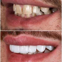 خدمات دندانپزشکی اقتصادی، فقط تا اخر دیماه