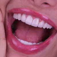مشاور تلفنی کلینیک دندانپزشکی افغان و عرب زبان