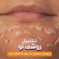 آموزش فیشال تخصصی با پشتیبانی ۶ ماهه