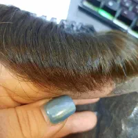 پروتز مو طبیعی وارداتی