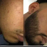 ریش میخای بیا اینجا