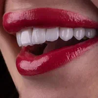 تخفیف های ویژه دندانپزشکی،کامپوزیت زیبایی،عصب کشی|خدمات آرایشگری و زیبایی|آبادان, |دیوار