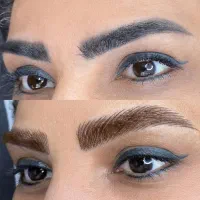 روشن سازی ومیکرو تتو تیره و بدرنگ بدون ریموو