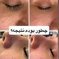 لیزر فول بادی فقط و فقط*۴۵۰ * بدوو که جا نمونی *|خدمات آرایشگری و زیبایی|زنجان, |دیوار