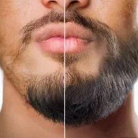 رویش ریش یا مو باما مصرف نسخه باشما