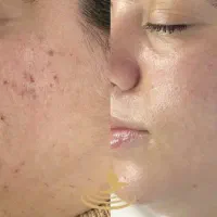 اجاره لاین فیشال در سالن فاطیما شهرک فرهنگیان