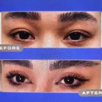 تخفیف پنجاه درصدی عیدانه بلفاروپلاستی تخصصی