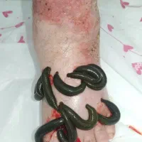 حجامت. فصد. زالو درمانی.|خدمات آرایشگری و زیبایی|مشهد, شاهد (شهرک غرب)|دیوار