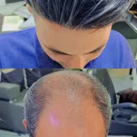 سالن vip پروتز مو کوروش سیناپور