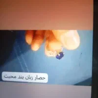 انواع پلاک موکل دار