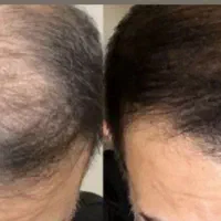 سرم تقویت‌کننده و اسپری نرم‌کننده مو آریا