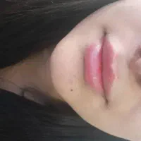 مدل ژل بوتاکس و پیرسینگ|خدمات آرایشگری و زیبایی|فولادشهر, مسکن مهر فولادشهر|دیوار