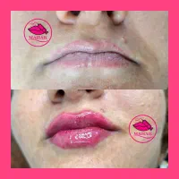آموزش ژل فیلربوتاکس پرسینگ شیدینگ لب|خدمات آموزشی|قم, شهرک قدس|دیوار