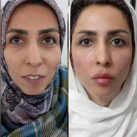 انواع خدمات پوست زیبایی در کلنیک