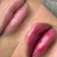 خدمات با تخفیف ژل و بوتاکس مزوژل در کلینیک پزشک|خدمات آرایشگری و زیبایی|اصفهان, وحید|دیوار