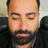 میکروبلیدینگ آقایان ،شیدینگ لب، بن مژه ،اسکالپ سر|خدمات آرایشگری و زیبایی|اصفهان, نقش جهان|دیوار