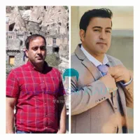 کاشت مو|خدمات آرایشگری و زیبایی|زنجان, |دیوار