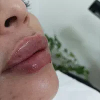 ژل بوتاکس فقط ۷۰۰|خدمات آرایشگری و زیبایی|مشهد, فرهنگ|دیوار