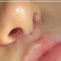 انجام تمام خدمات زیبایی صورت وبدن