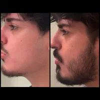 رویش در ۴۰ روز با محصولات گیاهی