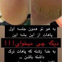 خدمات پودولوژی و پدیکور درمانی ، تخلیه میخچه و ..|خدمات آرایشگری و زیبایی|تهران, فردوس|دیوار