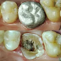 خیریه دندانپزشکی