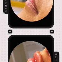 خدمات لیزر پوست،مو،زیبایی