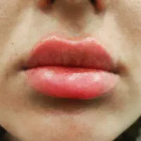 لیزر وزیبایی طلا|خدمات آرایشگری و زیبایی|سنندج, |دیوار