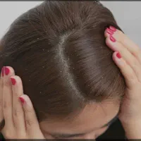 پاکسازی و رفع قطعی رشک و شپش