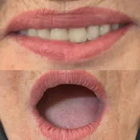 جدیدترین روش ساخت دندان مصنوعی/لابراتواردندانسازی‌|خدمات آرایشگری و زیبایی|تهران, افسریه شمالی|دیوار
