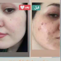 کرم طلا و صابون شیر الاغ و صابون شراب دست ساز اصل