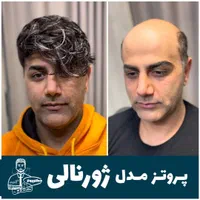 پروتزمو (دکترپروتز)|خدمات آرایشگری و زیبایی|اصفهان, هزارجریب|دیوار