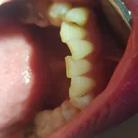 دستیار دندانپزشکی