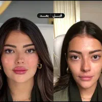 تخفیف 70 درصدی فیلر 890 بوتاکس790 نخ کل صورت 6900|خدمات زیبایی و سلامت|تهران, شهرآرا|دیوار