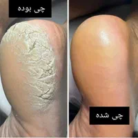 با ترک پاهات خدافظی کن فقط فردا ۳۸۰